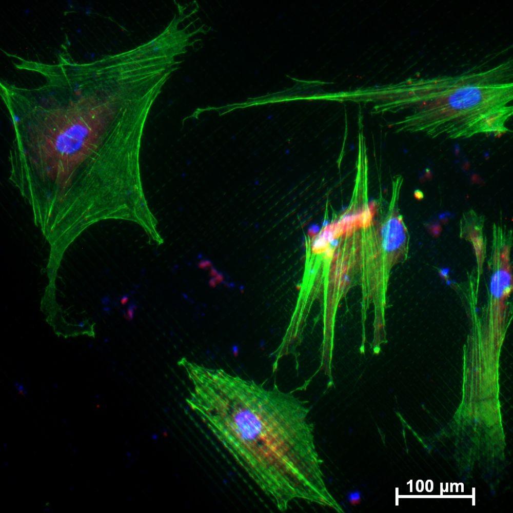Kovové biomateriály